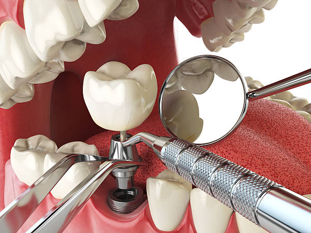 Best Emergency Gum Treatment in Camp Croft, SC